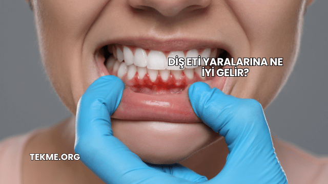 Diş Eti Yaralarına Ne İyi Gelir?