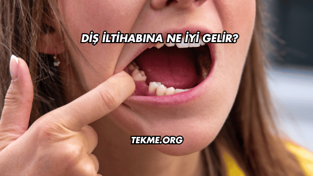 Diş İltihabına Ne İyi Gelir?