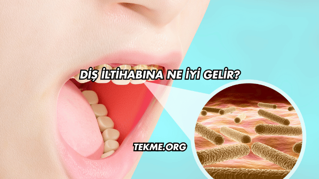 Diş İltihabına Ne İyi Gelir?
