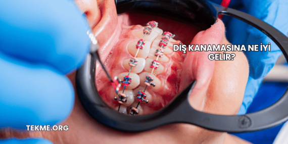 Diş Kanamasına Ne İyi Gelir?