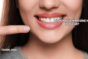 Diş Kemiği Erimesine Ne İyi Gelir?