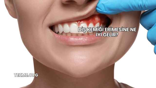 Diş Kemiği Erimesine Ne İyi Gelir?