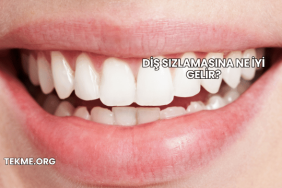 Diş Sızlamasına Ne İyi Gelir?