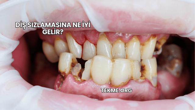 Diş Sızlamasına Ne İyi Gelir?