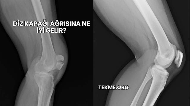 Diz Kapağı Ağrısına Ne İyi Gelir?