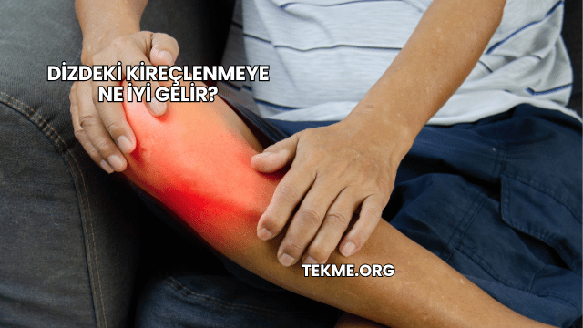 Dizdeki Kireçlenmeye Ne İyi Gelir?
