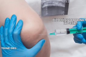 Dizdeki Sıvı Kaybına Ne İyi Gelir?