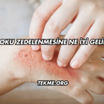 Doku Zedelenmesine Ne İyi Gelir?