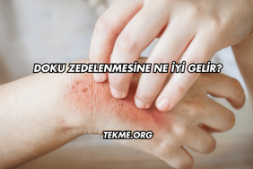Doku Zedelenmesine Ne İyi Gelir?