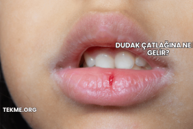 Dudak Çatlağına Ne İyi Gelir?