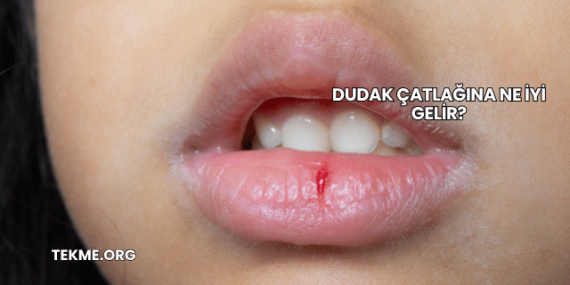 Dudak Çatlağına Ne İyi Gelir?