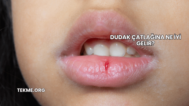 Dudak Çatlağına Ne İyi Gelir?
