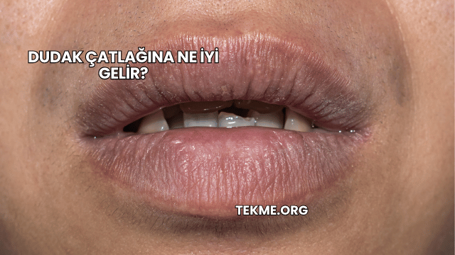 Dudak Çatlağına Ne İyi Gelir?