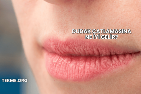 Dudak Çatlamasına Ne İyi Gelir?