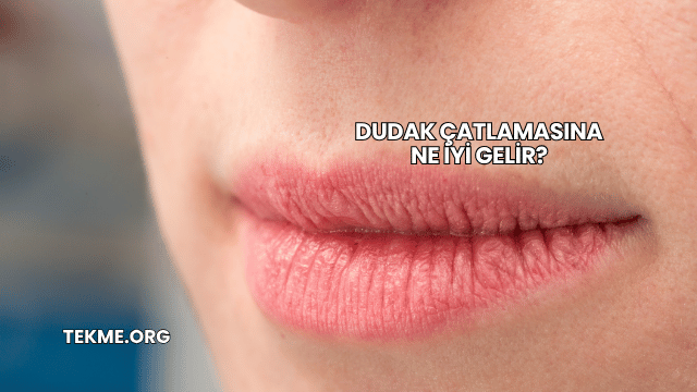 Dudak Çatlamasına Ne İyi Gelir?