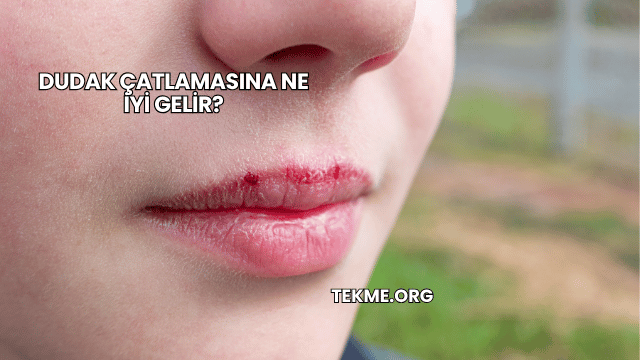 Dudak Çatlamasına Ne İyi Gelir?