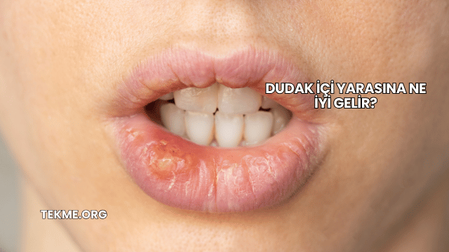 Dudak İçi Yarasına Ne İyi Gelir?