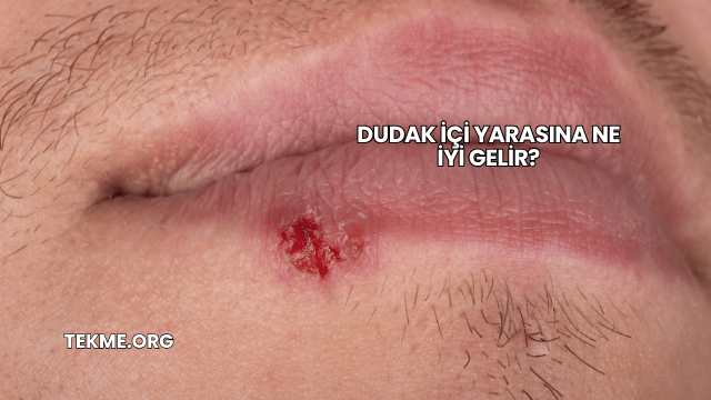 Dudak İçi Yarasına Ne İyi Gelir?