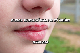 Dudak Kuruluğuna Ne İyi Gelir?