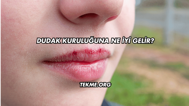Dudak Kuruluğuna Ne İyi Gelir?