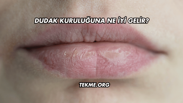 Dudak Kuruluğuna Ne İyi Gelir?