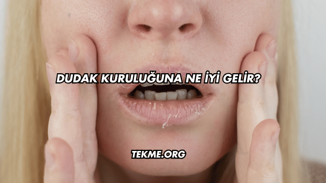 Dudak Kuruluğuna Ne İyi Gelir?