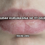 Dudak Kurumasına Ne İyi Gelir?