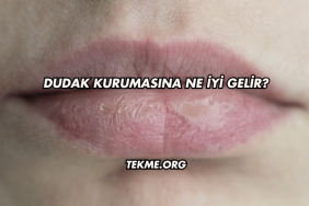 Dudak Kurumasına Ne İyi Gelir?