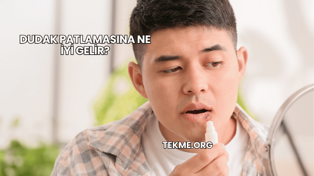 Dudak Patlamasına Ne İyi Gelir?
