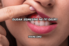 Dudak Şişmesine Ne İyi Gelir?