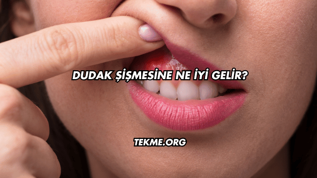 Dudak Şişmesine Ne İyi Gelir?