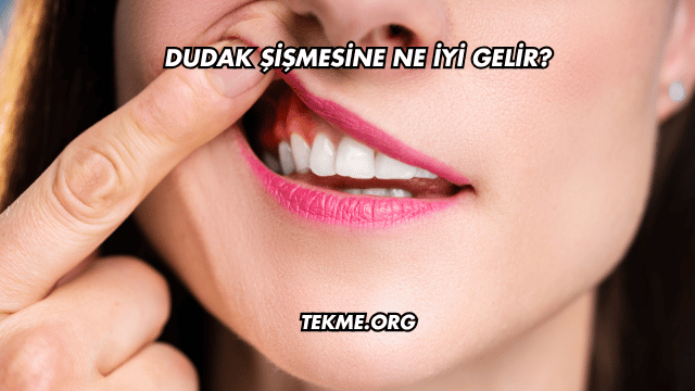 Dudak Şişmesine Ne İyi Gelir?