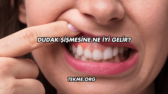 Dudak Şişmesine Ne İyi Gelir?