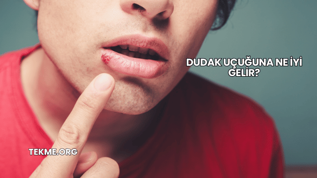 Dudak Uçuğuna Ne İyi Gelir?