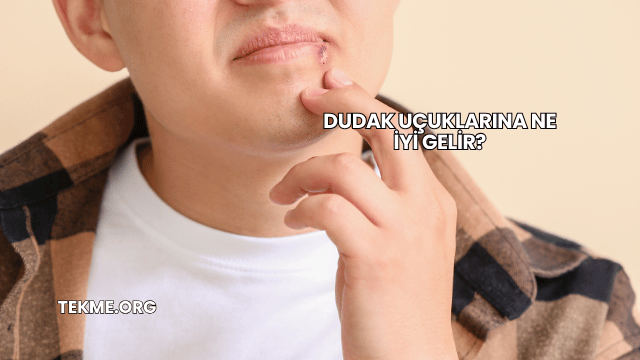 Dudak Uçuklarına Ne İyi Gelir?