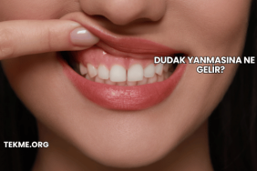 Dudak Yanmasına Ne İyi Gelir?