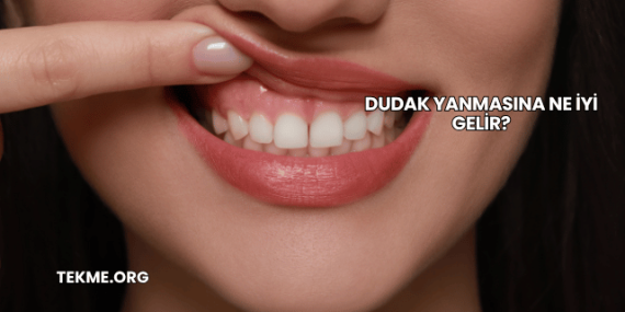 Dudak Yanmasına Ne İyi Gelir?