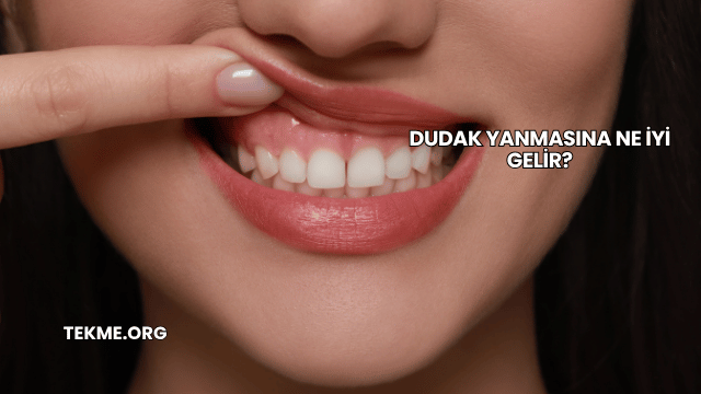 Dudak Yanmasına Ne İyi Gelir?
