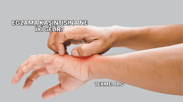 Egzama Kaşıntısına Ne İyi Gelir?