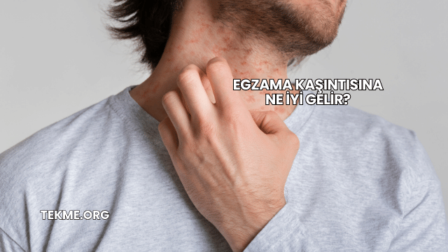 Egzama Kaşıntısına Ne İyi Gelir?