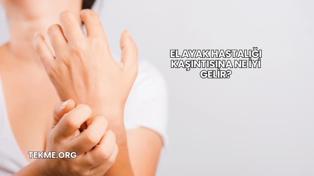 El Ayak Hastalığı Kaşıntısına Ne İyi Gelir?
