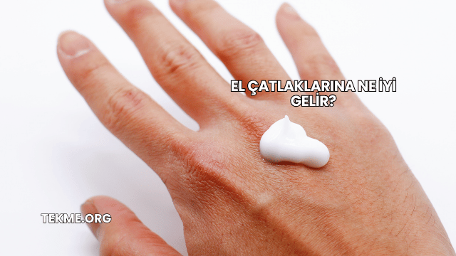 El Çatlaklarına Ne İyi Gelir?