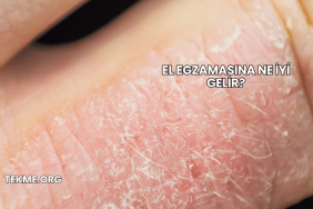 El Egzamasına Ne İyi Gelir?
