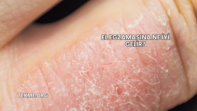 El Egzamasına Ne İyi Gelir?