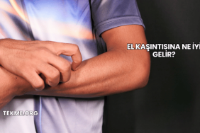 El Kaşıntısına Ne İyi Gelir?