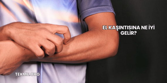 El Kaşıntısına Ne İyi Gelir?