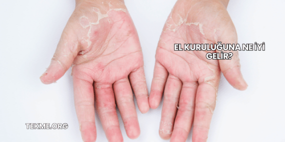 El Kuruluğuna Ne İyi Gelir?