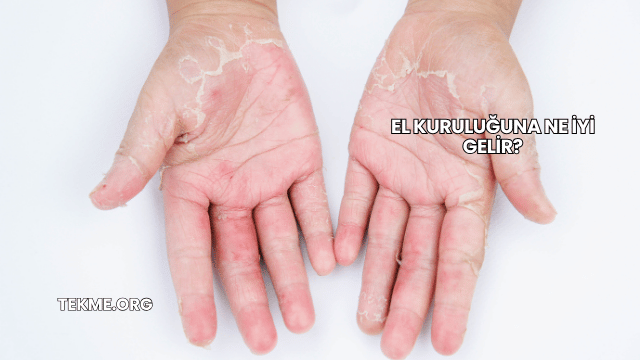 El Kuruluğuna Ne İyi Gelir?