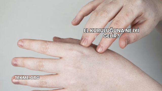 El Kuruluğuna Ne İyi Gelir?