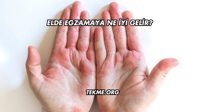 Elde Egzamaya Ne İyi Gelir?